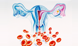 비정상적 자궁, 질 출혈