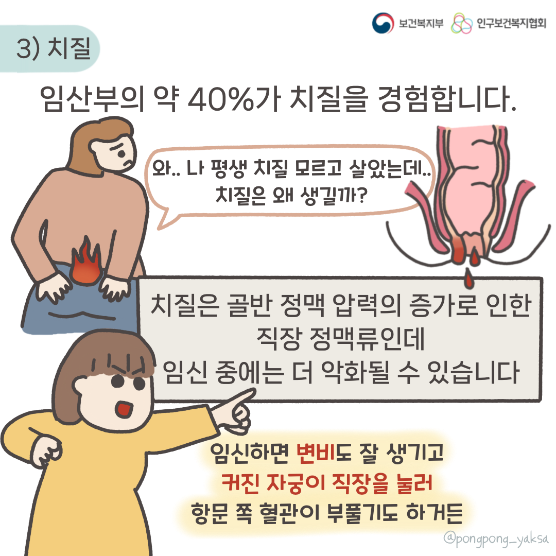 보건복지부 로고,인구보건복지협회 로고,3) 치질,임산부의 약 40%가 치질을 경험합니다,와.. 나 평생 치질 모르고 살았는데.. 치질은 왜 생길까?,치질은 골반 정맥 압력의 증가로 인한 직장 정맥류인데 임신 중에는 더 악화될 수 있습니다,임신하면 변비도 잘 생기고 커진 자궁이 직장을 눌러 항문 쪽 혈관이 부풀기도 하거든,@pongpong_yaksa