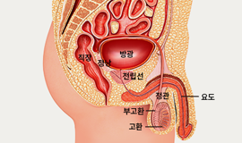 부고환염