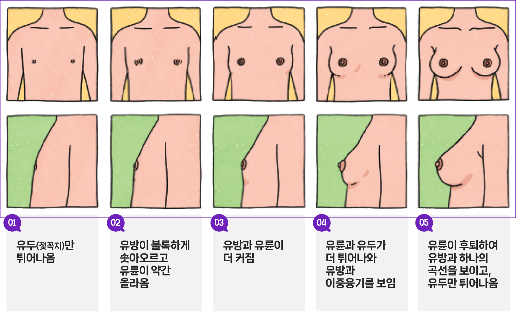 유방의 발달 - 제1단계 유두(젖꼭지)만 튀어나옴, 제2단계 유방이 볼록하게 솟아오르고 유륜이 약간 올라옴, 제3단계 유방과 유륜이 더 커짐, 제4단계 유륜과 유두가 더 튀어나와 유방과 이중융기를 보임, 제5단계 유륜이 후퇴하여 유방과 하나의 곡선을 보이고, 유두만 튀어나옴