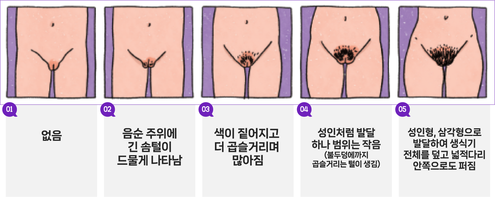 음모의 발달 - 제1단계 없음, 제2단계 음순 주위에 긴 솜털이 드물게 나타남, 제3단계 색이 짙어지고 더 곱슬거리며 많아짐, 제4단계 성인처럼 발달하나 범위는 작음(불두덩이까지 곱슬거리는 털이 생김), 제5단계 성인형, 삼각형으로 발달하여 생식기 전체를 덮고 넒적다리 안쪽으로도 퍼짐